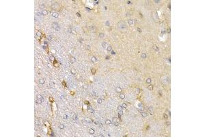 Immunohistochemistry of paraffin-embedded rat brain using SFRP2 antibody (ABIN5973117) at dilution of 1/200 (40x lens). (SFRP2 Antikörper)