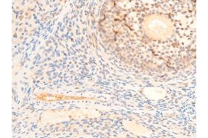 ABIN6267235 at 1/100 staining rat ovarian tissue sections by IHC-P. (PDPK1 Antikörper  (pSer241))