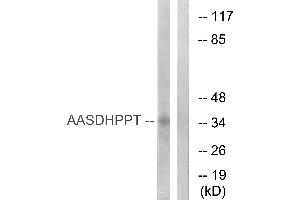 Western blot analysis of extracts from COLO cells, using AASDHPPT antibody. (AASDHPPT Antikörper  (Internal Region))