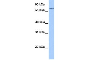 WB Suggested Anti-FOXO1 Antibody Titration:  0. (FOXO1 Antikörper  (C-Term))