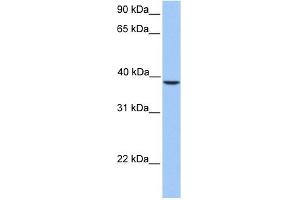SUNC1 antibody used at 1 ug/ml to detect target protein. (SUN3 Antikörper  (C-Term))