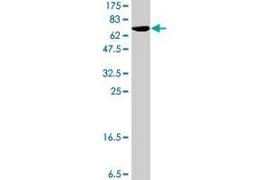 Western Blot detection against Immunogen (62. (SPDEF/PSE Antikörper  (AA 1-335))