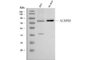 Western blot analysis of Scavenging Receptor SRB2/SCARB2 using anti-Scavenging Receptor SRB2/SCARB2 antibody (ABIN7601833).