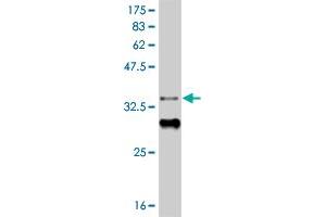 Western Blot detection against Immunogen (34. (HIC1 Antikörper  (AA 627-705))