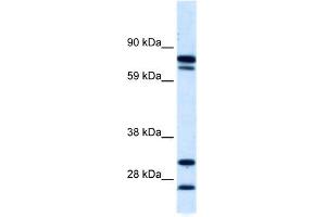 WB Suggested Anti-ZNF606 Antibody Titration:  0. (ZNF606 Antikörper  (N-Term))