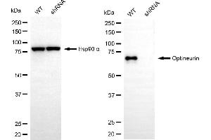Western blotting analysis using optineurin antibody (ABIN7799705). (Rekombinanter OPTN Antikörper)