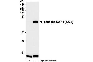 Western Blotting (WB) image for anti-Tripartite Motif Containing 28 (TRIM28) (pSer824) antibody (ABIN7455183)