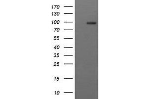 Image no. 2 for anti-CD22 Molecule (CD22) antibody (ABIN1497211) (CD22 Antikörper)