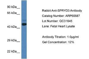 Western Blotting (WB) image for anti-SPRY Domain Containing 3 (SPRYD3) (N-Term) antibody (ABIN2788536) (SPRYD3 Antikörper  (N-Term))