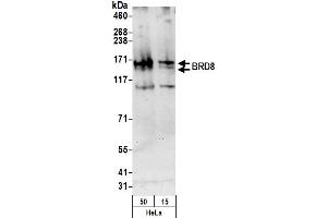 anti-Bromodomain Containing 8 (BRD8) (AA 25-75) antibody