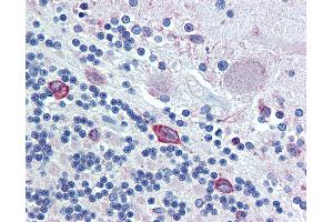 Anti-ERp72 antibody IHC of human brain, cerebellum. (PDIA4 Antikörper  (AA 623-638))