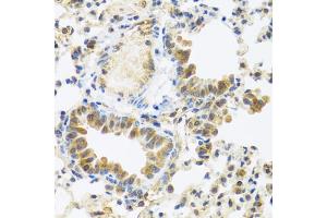 Immunohistochemistry of paraffin-embedded mouse lung using C8orf4 antibody (ABIN5975014) at dilution of 1/100 (40x lens). (C8orf4 Antikörper)
