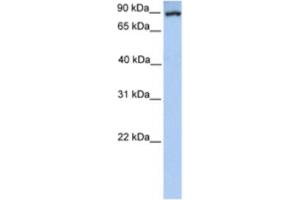 Western Blotting (WB) image for anti-phosphoenolpyruvate Carboxykinase 1 (Soluble) (PCK1) antibody (ABIN2460581) (PCK1 Antikörper)