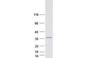 Western Blotting (WB) image for Deoxyhypusine Hydroxylase/monooxygenase (DOHH) (Transcript Variant 2) protein (Myc-DYKDDDDK Tag) (ABIN2719643)