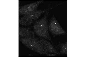 Immunofluorescence staining of Autophagy UVRAG Antibody  on Methanol-fixed HeLa cells. (UVRAG Antikörper  (C-Term))