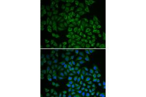 Immunofluorescence analysis of HeLa cells using SGK1 antibody (ABIN5970402).
