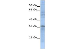 WB Suggested Anti-MTCH2  Antibody Titration: 0. (MTCH2 Antikörper  (N-Term))