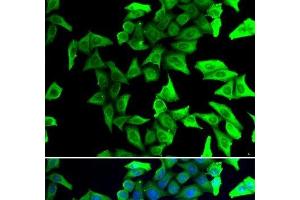 Immunofluorescence analysis of U2OS cells using VSNL1 Polyclonal Antibody (VSNL1 Antikörper)