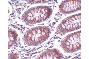 Immunohistochemistry of MICA in human colon tissue with MICA polyclonal antibody  at 10 ug/mL .