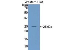 Western Blotting (WB) image for anti-Laminin, alpha 4 (LAMa4) (AA 832-1039) antibody (ABIN1078265) (LAMa4 Antikörper  (AA 832-1039))