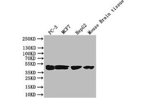 Western Blot Positive WB detected in: PC-3 whole cell lysate, Mouse liver tissue All lanes: DGAT2 antibody at 3 μg/mL Secondary Goat polyclonal to rabbit IgG at 1/50000 dilution Predicted band size: 44, 40 kDa Observed band size: 44 kDa (DGAT2 Antikörper  (AA 1-66))