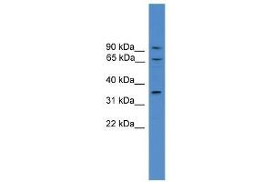 Western Blot showing CCIN antibody used at a concentration of 1-2 ug/ml to detect its target protein. (Calicin Antikörper  (N-Term))