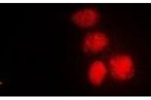 Immunofluorescent analysis of XPV staining in HepG2 cells. (POLH Antikörper)