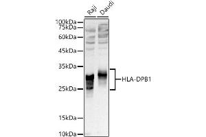 Western blot analysis of extracts of various cell lines, using HLA-DPB1 antibody (ABIN7268370) at 1:1000 dilution.