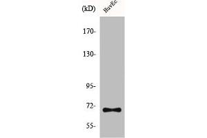 Western Blot analysis of HuvEc cells using CTPS Polyclonal Antibody (CTP Synthase Antikörper  (N-Term))