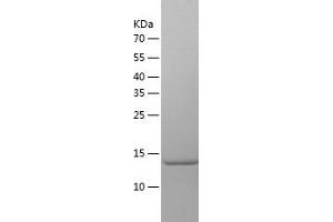 Western Blotting (WB) image for Ubiquitin-Conjugating Enzyme E2 Variant 2 (UBE2V2) (AA 2-145) protein (His tag) (ABIN7287310) (UBE2V2 Protein (AA 2-145) (His tag))