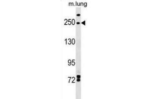 Western Blotting (WB) image for anti-Inverted Formin, FH2 and WH2 Domain Containing (INF2) antibody (ABIN2999620) (INF2 Antikörper)
