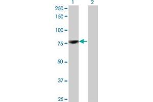 Western Blot analysis of PRKCD expression in transfected 293T cell line by PRKCD monoclonal antibody (M07), clone 8E12. (PKC delta Antikörper  (AA 577-676))