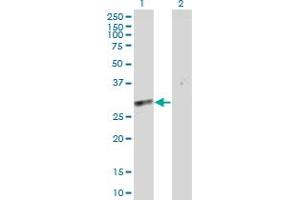 Western Blot analysis of SLC25A5 expression in transfected 293T cell line by SLC25A5 MaxPab polyclonal antibody. (SLC25A5 Antikörper  (AA 1-298))
