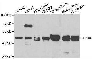 Western blot analysis of extracts of various cell lines, using PAX6 antibody. (PAX6 Antikörper  (AA 1-300))