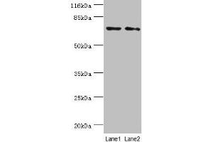 Western blot All lanes: MAGEC3 antibody at 2 μg/mL Lane 1: A375 whole cell lysate Lane 2: Rat thymus tissue Secondary Goat polyclonal to rabbit IgG at 1/10000 dilution Predicted band size: 72, 39 kDa Observed band size: 72 kDa (MAGEC3 Antikörper  (AA 75-197))