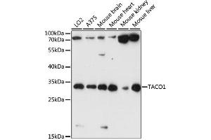 Western blot analysis of extracts of various cell lines, using TACO1 antibody (ABIN6292793) at 1:1000 dilution.