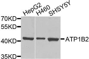 Western blot analysis of extracts of various cells, using ATP1B2 antibody. (ATP1B2 Antikörper)