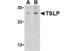 Western blot analysis of TSLP in Jurkat cell lysate with this product at (A) 1 and (B) 2 μg/ml. (Thymic Stromal Lymphopoietin Antikörper  (C-Term))