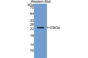 Western Blotting (WB) image for anti-Slow Skeletal Troponin I (TNNI1) (AA 1-187) antibody (ABIN1176057) (TNNI1 Antikörper  (AA 1-187))