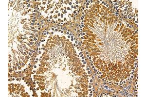 ABIN7095754 and ABIN7099816 at 1/100 staining rat testis tissue by IHC-P. (ERVK-18 Antikörper)