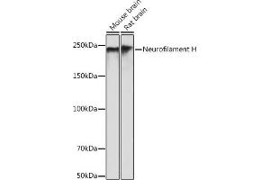 Western blot analysis of extracts of various cell lines, using Neurofilament H antibody (ABIN7268866) at 1:500 dilution. (NEFH Antikörper)