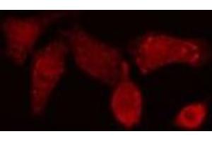 ABIN6276815 staining NIH-3T3 cells by IF/ICC. (POLB Antikörper  (C-Term))
