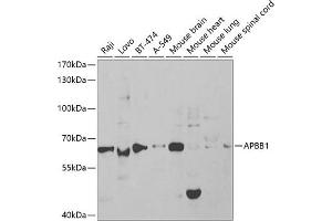 Western blot analysis of extracts of various cell lines, using  antibody (ABIN6129919, ABIN6136973, ABIN6136974 and ABIN6219091) at 1:1000 dilution.