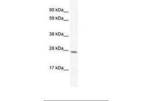 Image no. 2 for anti-General Transcription Factor IIF, Polypeptide 2, 30kDa (GTF2F2) (C-Term) antibody (ABIN6735897) (GTF2F2 Antikörper  (C-Term))