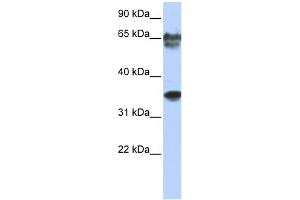 WB Suggested Anti-NKX3-2 Antibody Titration: 0. (NKX3-2 Antikörper  (N-Term))