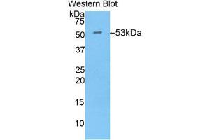 Western Blotting (WB) image for anti-Isocitrate Dehydrogenase 1 (NADP+), Soluble (IDH1) (AA 99-325) antibody (ABIN1859250) (IDH1 Antikörper  (AA 99-325))