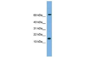IL1 beta antibody used at 1 ug/ml to detect target protein. (IL-1 beta Antikörper  (N-Term))