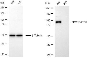 Western blotting analysis using SATB2 antibody (ABIN7800274). (Rekombinanter SATB2 Antikörper)