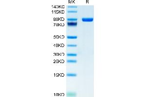 Human CD5 on Tris-Bis PAGE under reduced condition.
