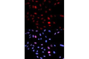 Immunofluorescence (IF) image for anti-Structural Maintenance of Chromosomes 1A (SMC1A) (pSer957) antibody (ABIN1870618) (SMC1A Antikörper  (pSer957))